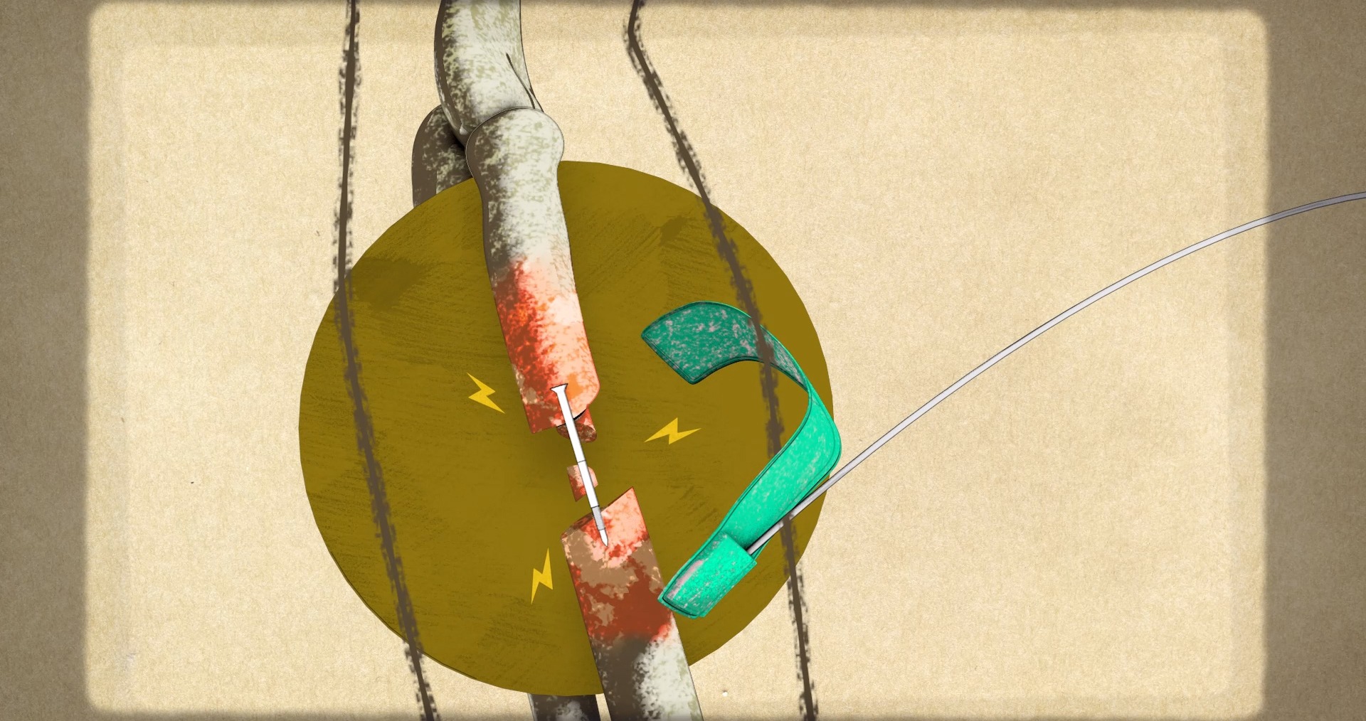 Illustration eines zerrissenen Seils mit Nadel und grünem Band auf gelbem Hintergrund. Metapher für Verbindung.
