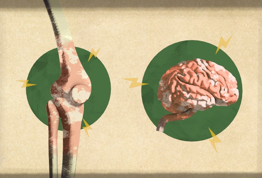 Darstellung eines menschlichen Knies und Gehirns mit Blitzen, die Schmerz oder Verbindung symbolisieren.